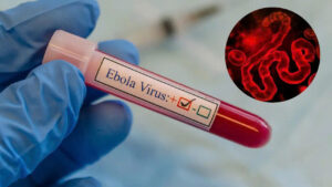 WHO lo ngại tốc độ lây lan Ebola tại Congo, hơn 130 người tử vong