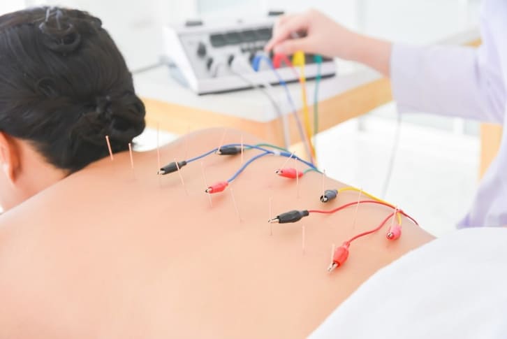 Châm cứu hỗ trợ kiểm soát đau mạn tính